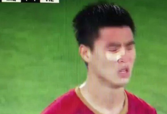 Duy Mạnh thi đấu với gương mặt đẫm máu