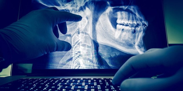 AI là công cụ hỗ trợ đắc lực cho ngành y tế. (Ảnh: Internet).