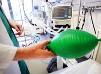 Máy thở là gì và vì sao nó rất quan trọng trong cuộc chiến Covid-19?