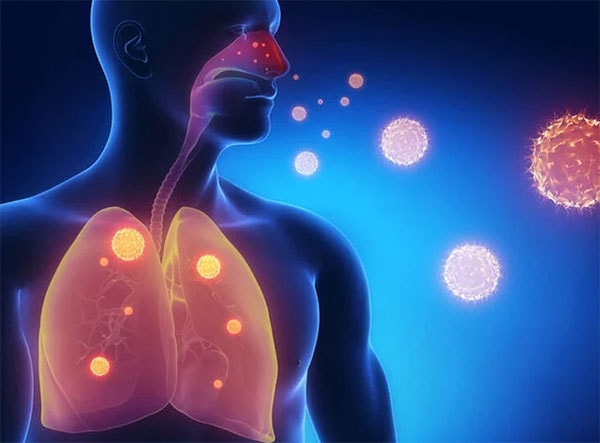 Cúm Tây Ban Nha từng trực tiếp gây ra cái chết cho khoảng 100 triệu người.