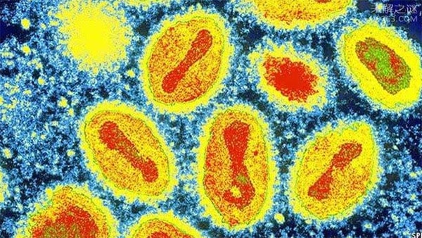 Ảnh: Virus đậu mùa