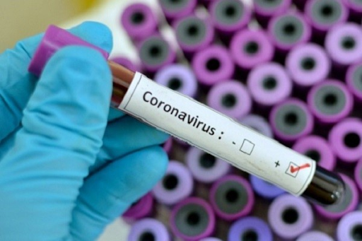 Việc virus SARS-CoV-2 có thể tích hợp RNA vào bộ gen có khả năng gây ra các trường hợp dương tính giả 