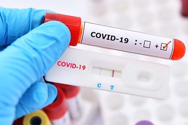 dù kit xét nghiệm hiển thị hai vạch đậm hay nhạt đều thể hiện dương tính với COVID-19, nhưng lại không nói lên được nồng độ virus ít hay nhiều.