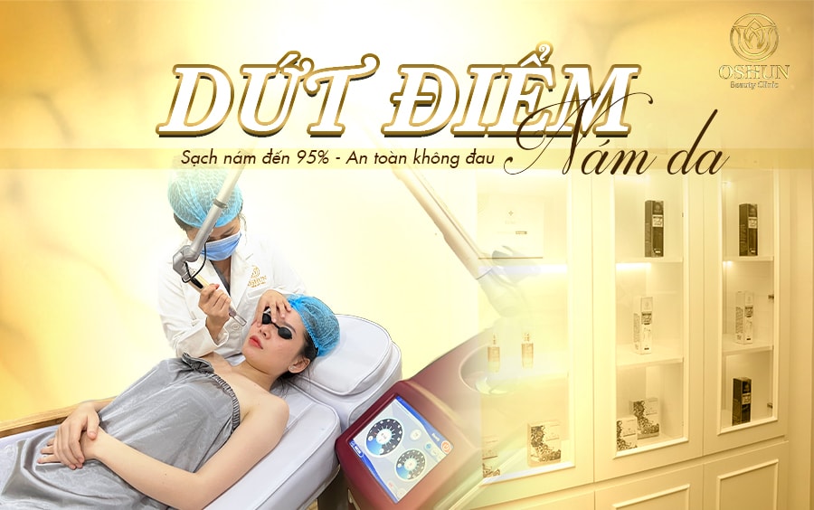 Điều trị nám da bằng công nghệ Laser Multi Picosure tại TMV Oshun Biên Hòa hiệu quả sau 1 liệu trình đầu tiên.