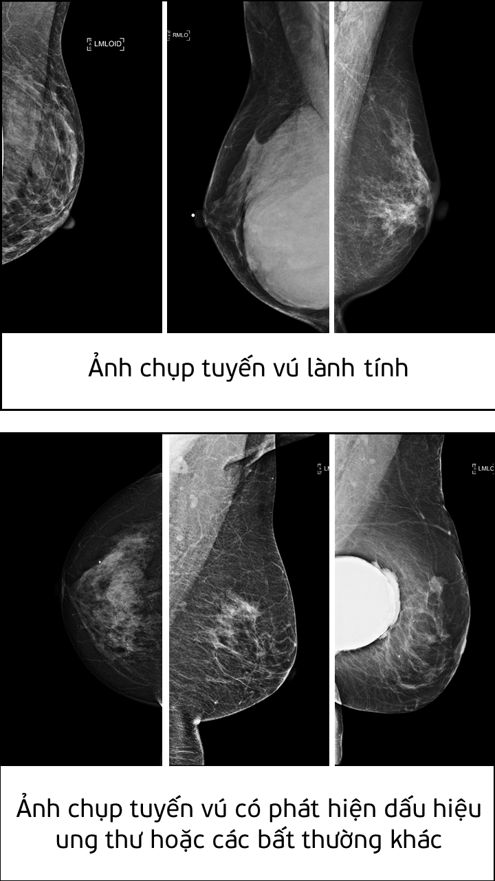 Giải pháp này có thể tích hợp vào hệ thống hỗ trợ phân tích (Computer-aided diagnosis - CADx systems) nhằm cải thiện tính chính xác trong việc chẩn đoán và khám chữa bệnh.