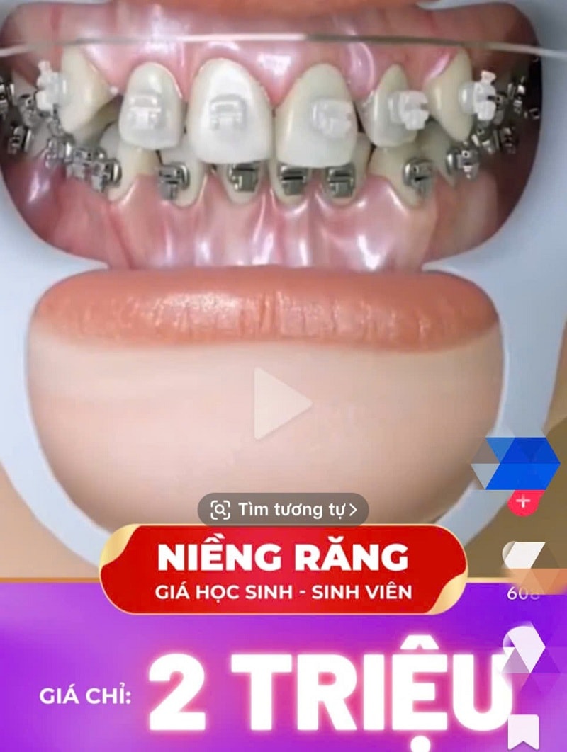 nieng-rang-gia-re-loi-hua-dep-hau-qua-dau-4.jpg