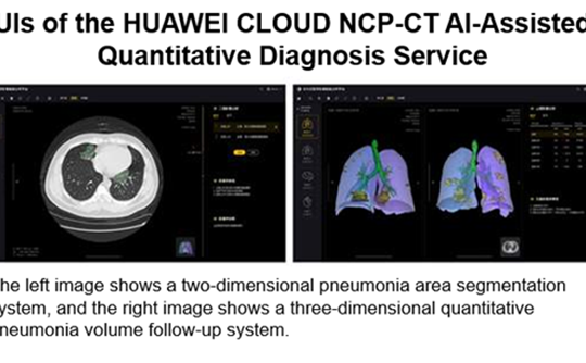 Trí tuệ nhân tạo hỗ trợ bác sĩ chẩn đoán bệnh nhân COVID-19