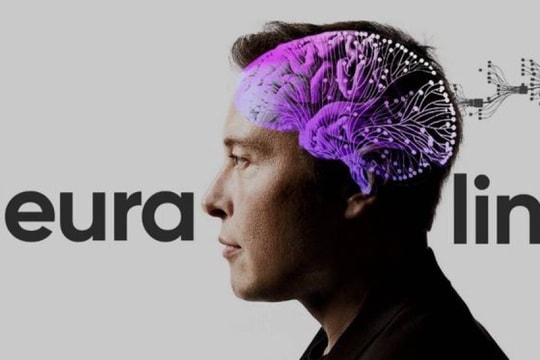 Công ty khởi nghiệp Neuralink của Elon Musk bắt đầu thử nghiệm trên người