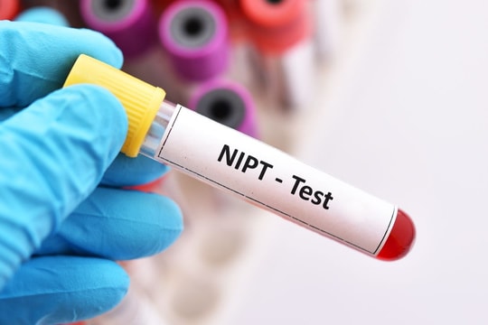 NIPT, công nghệ xét nghiệm gene hiện đại