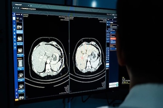 Startup VinBrain ứng dụng AI phục vụ hơn 180 bệnh viện khắp thế giới