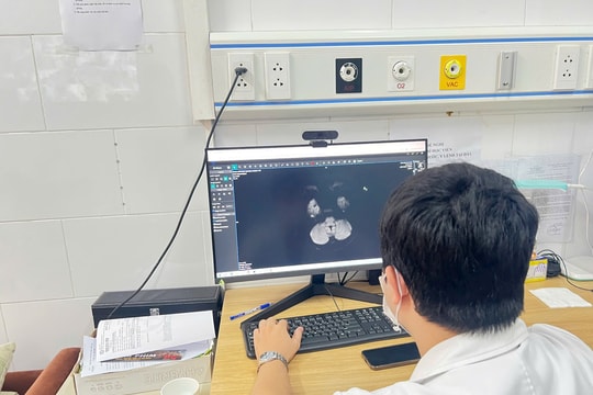 Thiếu niên 15 tuổi tổn thương não vì ngộ độc thuốc lá điện tử chứa ma túy