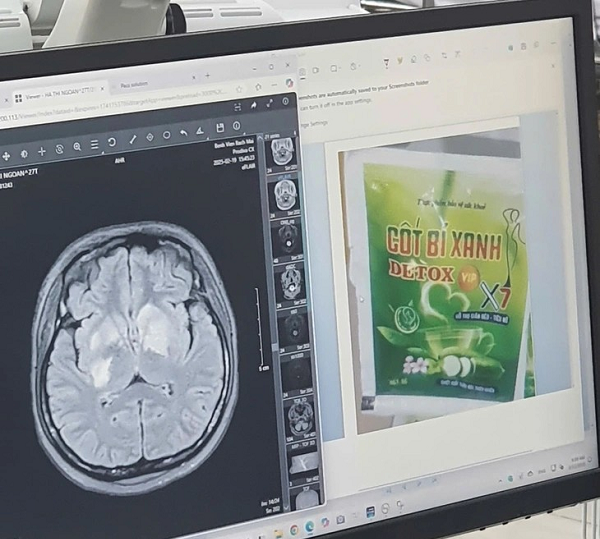 “Tử huyệt” hậu kiểm – Kỳ 3: Sự gian dối được “hợp pháp hoá”